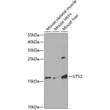 Western Blot - Anti-Urotensin II Antibody (A11824) - Antibodies.com