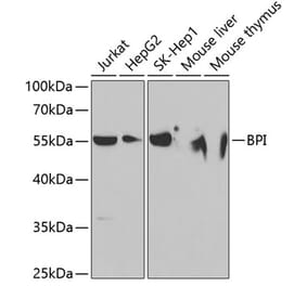 Western Blot - Anti-BPI Antibody (A11825) - Antibodies.com