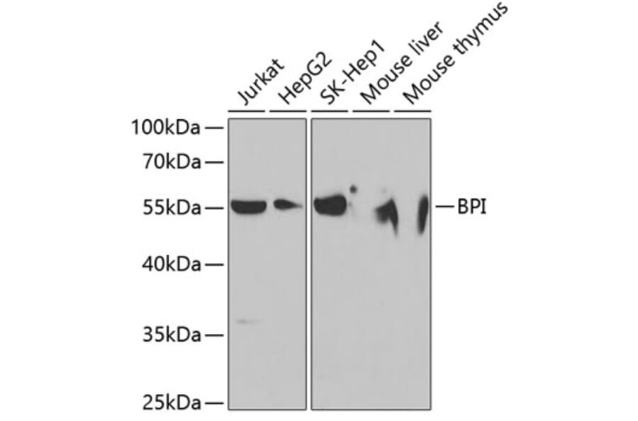 Western Blot - Anti-BPI Antibody (A11825) - Antibodies.com