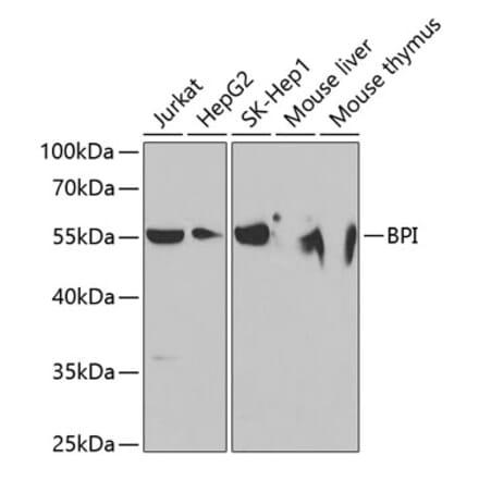 Western Blot - Anti-BPI Antibody (A11825) - Antibodies.com