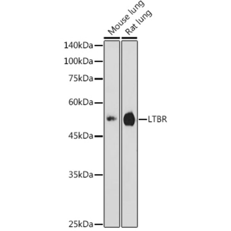 Western Blot - Anti-LTBR Antibody (A11826) - Antibodies.com