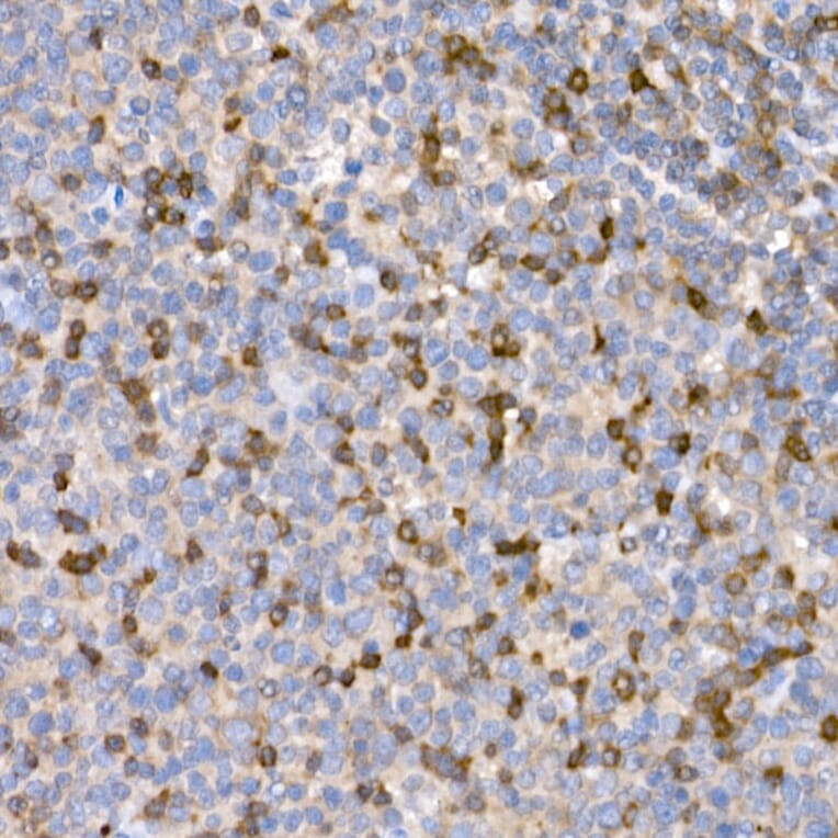 Immunohistochemistry - Anti-LTBR Antibody (A11826) - Antibodies.com