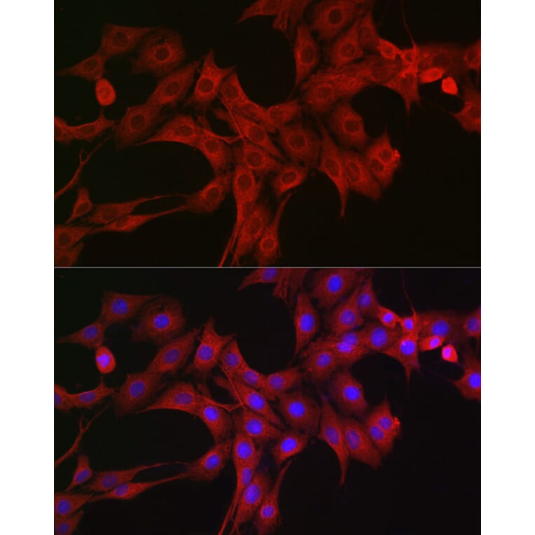 Immunofluorescence - Anti-LTBR Antibody (A11826) - Antibodies.com