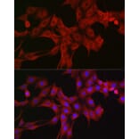 Immunofluorescence - Anti-LTBR Antibody (A11826) - Antibodies.com