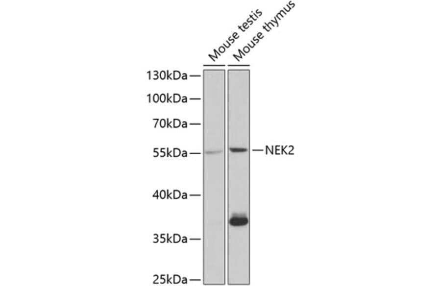 Western Blot - Anti-NEK2 Antibody (A11827) - Antibodies.com