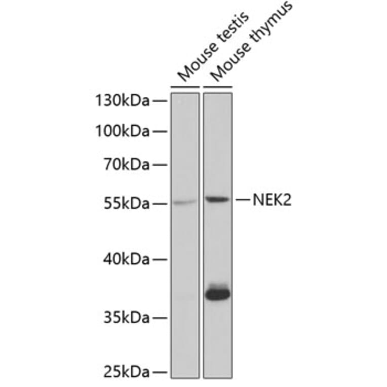 Western Blot - Anti-NEK2 Antibody (A11827) - Antibodies.com