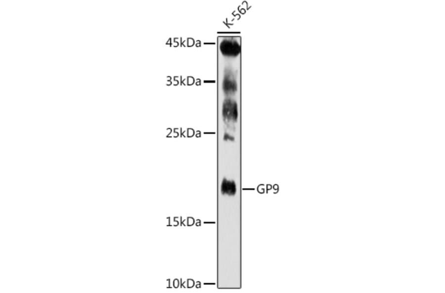 Western Blot - Anti-CD42a/GP-IX Antibody (A11828) - Antibodies.com