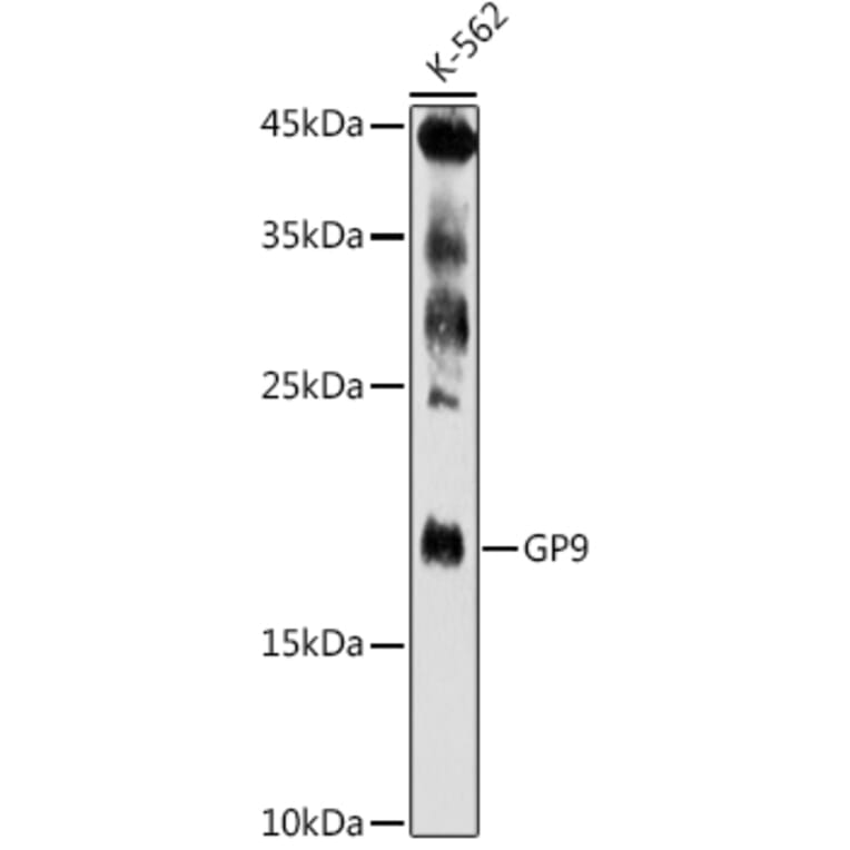 Western Blot - Anti-CD42a/GP-IX Antibody (A11828) - Antibodies.com