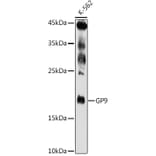 Western Blot - Anti-CD42a/GP-IX Antibody (A11828) - Antibodies.com