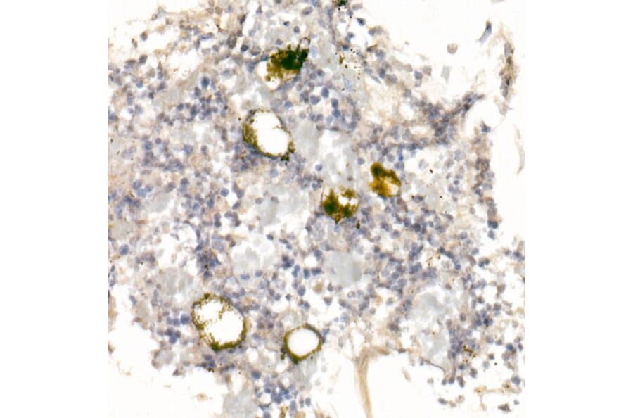 Immunohistochemistry - Anti-CD42a/GP-IX Antibody (A11828) - Antibodies.com