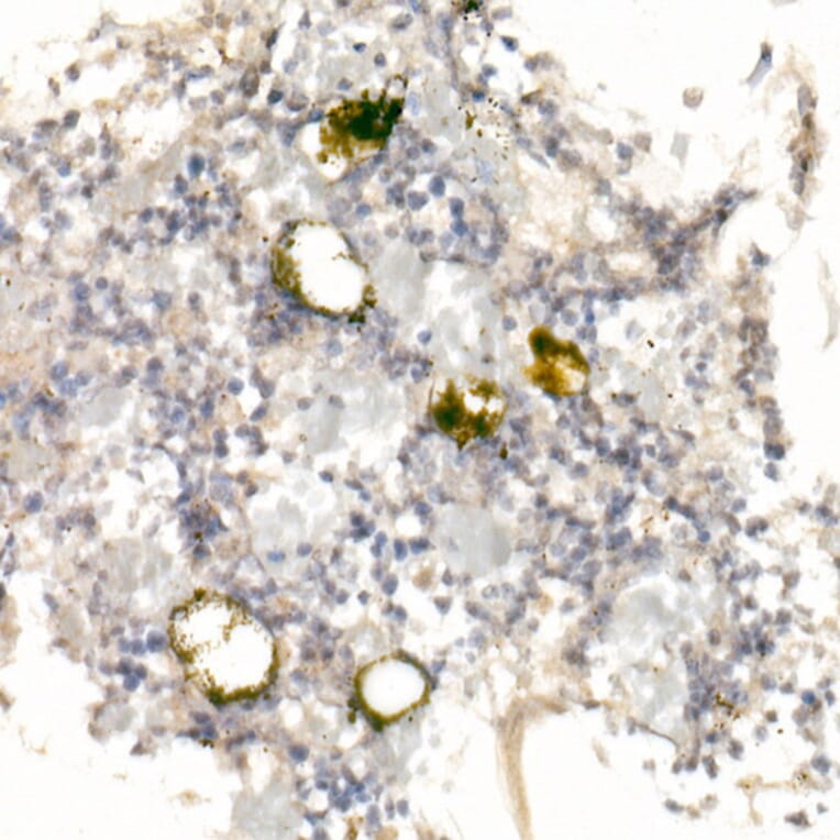 Immunohistochemistry - Anti-CD42a/GP-IX Antibody (A11828) - Antibodies.com