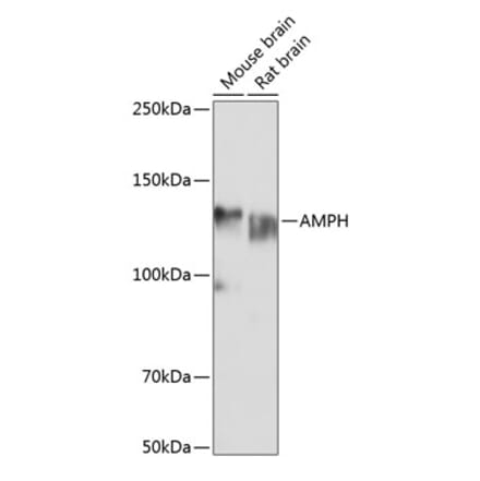 Western Blot - Anti-Amphiphysin Antibody (A11829) - Antibodies.com