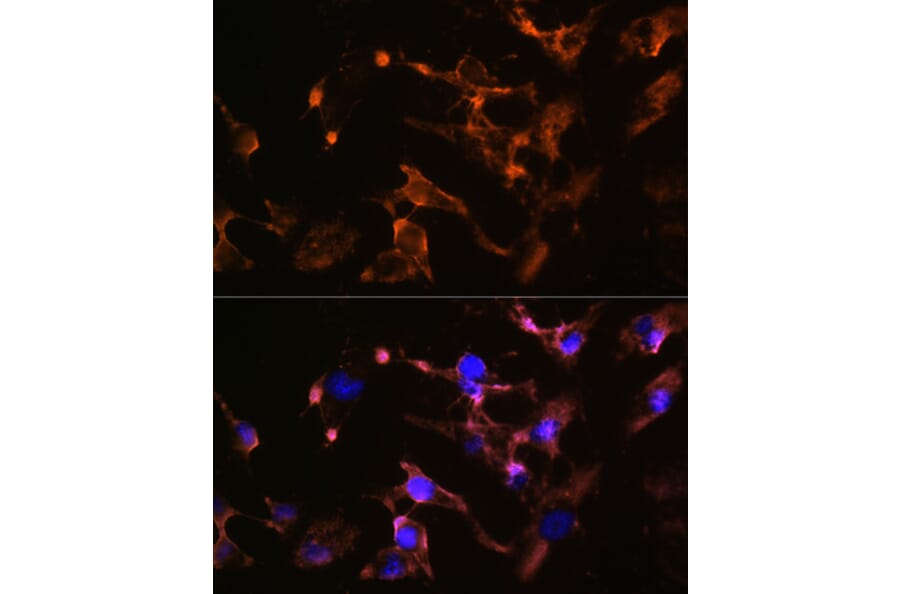 Immunofluorescence - Anti-Amphiphysin Antibody (A11829) - Antibodies.com