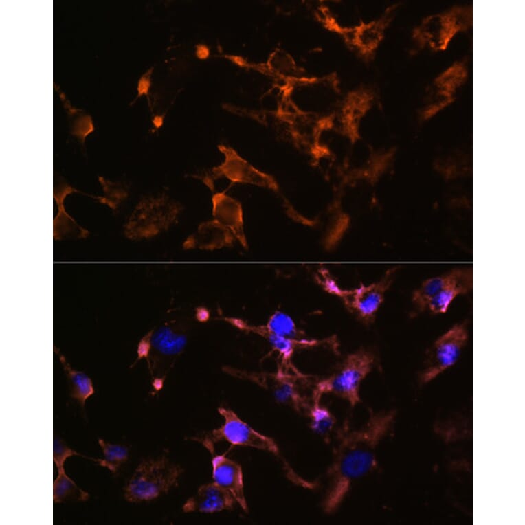 Immunofluorescence - Anti-Amphiphysin Antibody (A11829) - Antibodies.com
