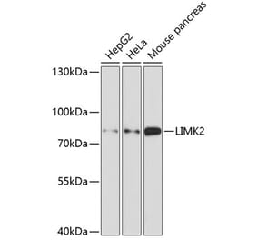 Western Blot - Anti-LIMK2 Antibody (A11830) - Antibodies.com