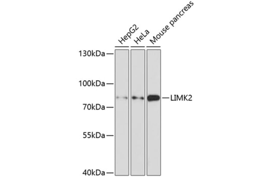 Western Blot - Anti-LIMK2 Antibody (A11830) - Antibodies.com