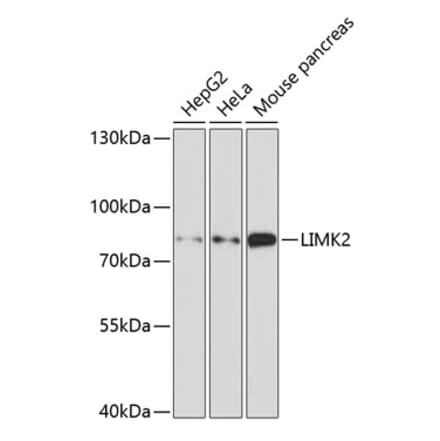 Western Blot - Anti-LIMK2 Antibody (A11830) - Antibodies.com