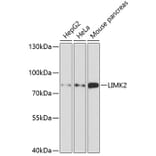 Western Blot - Anti-LIMK2 Antibody (A11830) - Antibodies.com