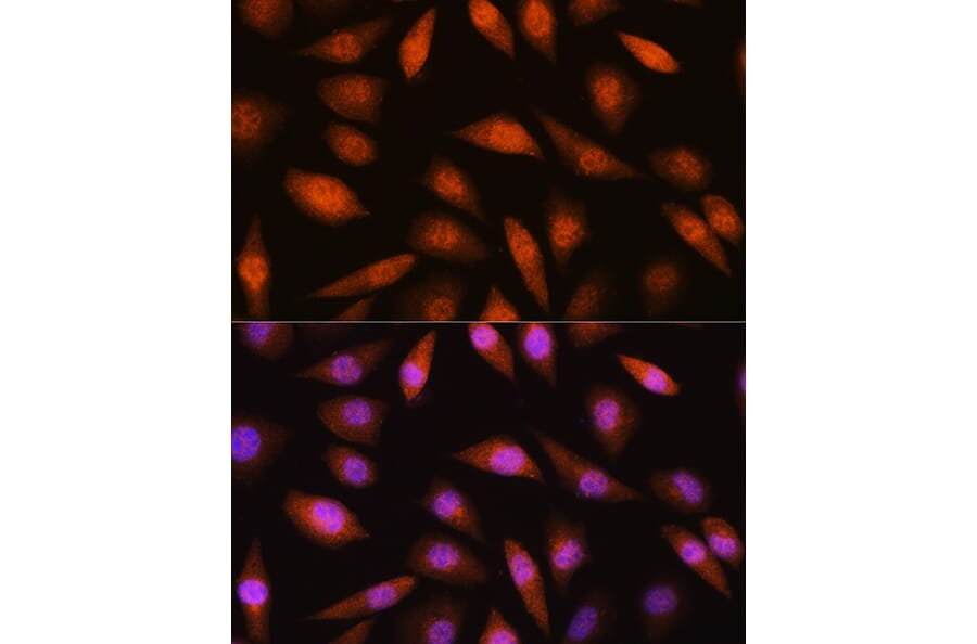 Immunofluorescence - Anti-LIMK2 Antibody (A11830) - Antibodies.com