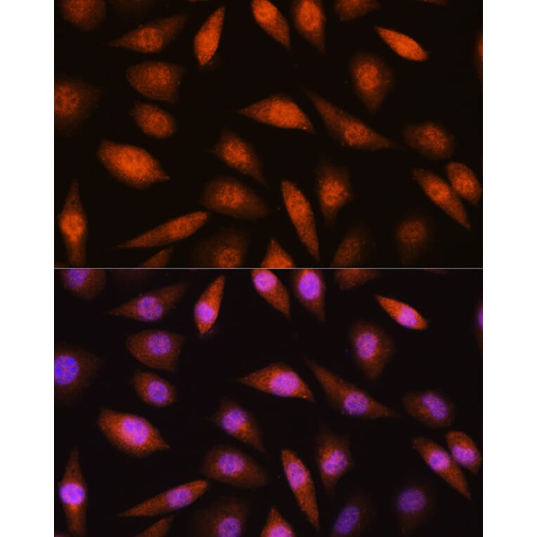 Immunofluorescence - Anti-LIMK2 Antibody (A11830) - Antibodies.com