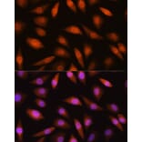 Immunofluorescence - Anti-LIMK2 Antibody (A11830) - Antibodies.com