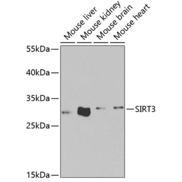 Western Blot - Anti-SIRT3 Antibody (A5419) - Antibodies.com