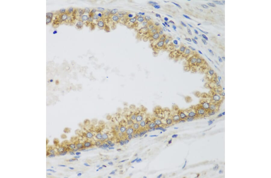 Immunohistochemistry - Anti-SIRT3 Antibody (A5419) - Antibodies.com