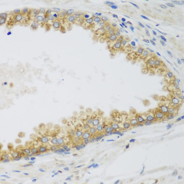 Immunohistochemistry - Anti-SIRT3 Antibody (A5419) - Antibodies.com