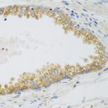 Immunohistochemistry - Anti-SIRT3 Antibody (A5419) - Antibodies.com