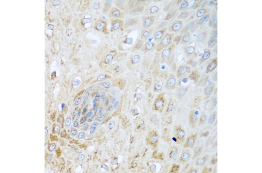 Immunohistochemistry - Anti-SIRT3 Antibody (A5419) - Antibodies.com