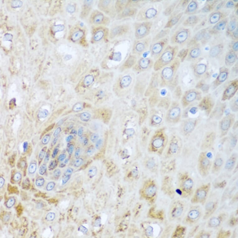 Immunohistochemistry - Anti-SIRT3 Antibody (A5419) - Antibodies.com