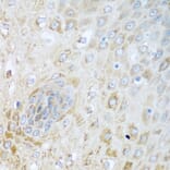 Immunohistochemistry - Anti-SIRT3 Antibody (A5419) - Antibodies.com