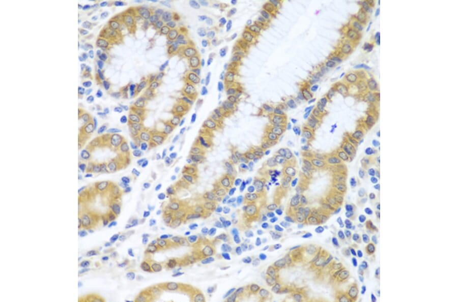 Immunohistochemistry - Anti-SIRT3 Antibody (A5419) - Antibodies.com