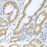 Immunohistochemistry - Anti-SIRT3 Antibody (A5419) - Antibodies.com