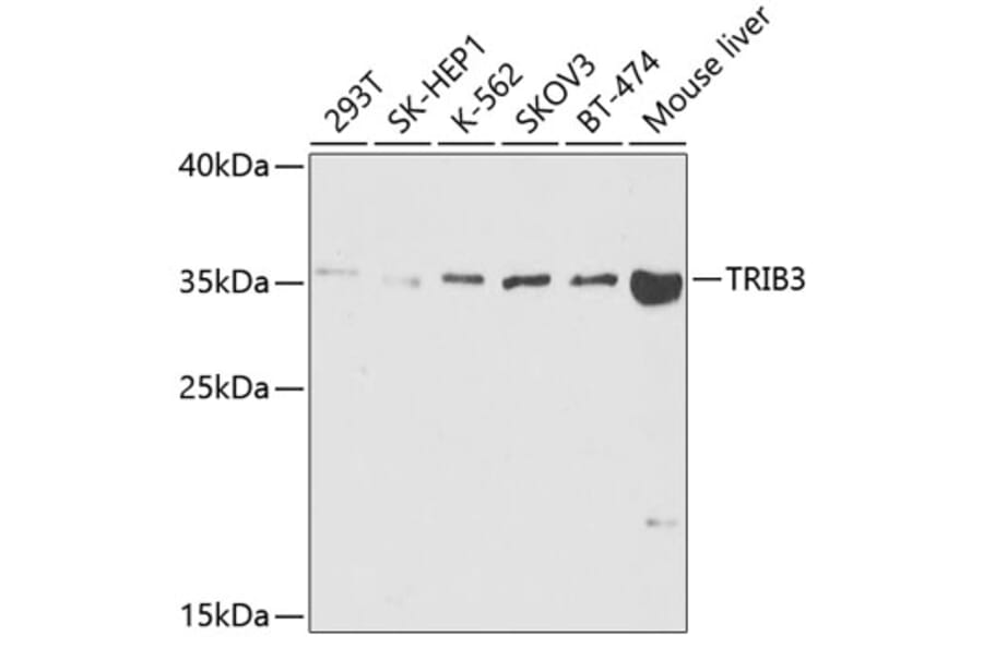 Western Blot - Anti-TRIB3 Antibody (A5424) - Antibodies.com