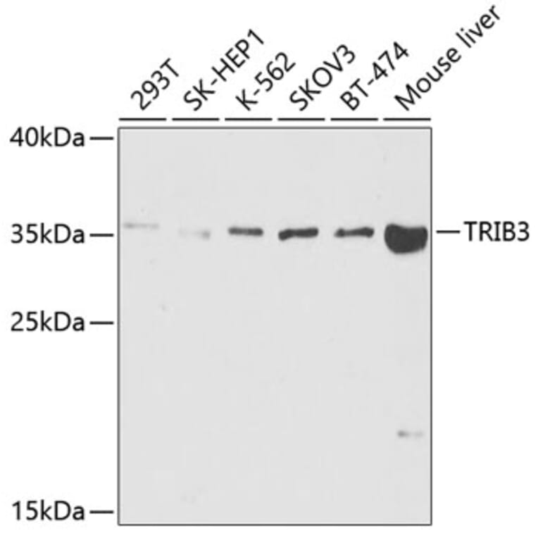 Western Blot - Anti-TRIB3 Antibody (A5424) - Antibodies.com