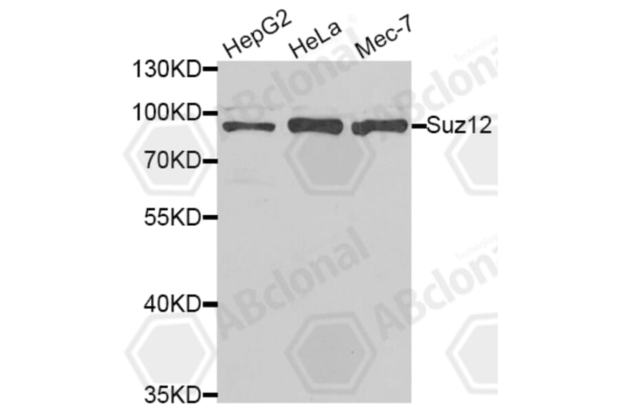 Western Blot - Anti-Suz12 Antibody (A5429) - Antibodies.com