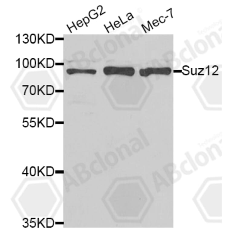 Western Blot - Anti-Suz12 Antibody (A5429) - Antibodies.com