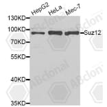 Western Blot - Anti-Suz12 Antibody (A5429) - Antibodies.com