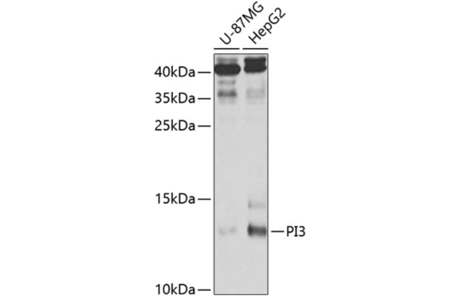 Western Blot - Anti-Elafin/ESI Antibody (A11834) - Antibodies.com