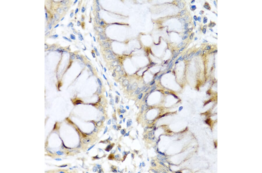 Immunohistochemistry - Anti-Elafin/ESI Antibody (A11834) - Antibodies.com