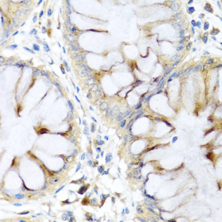 Immunohistochemistry - Anti-Elafin/ESI Antibody (A11834) - Antibodies.com