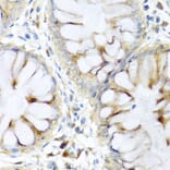 Immunohistochemistry - Anti-Elafin/ESI Antibody (A11834) - Antibodies.com