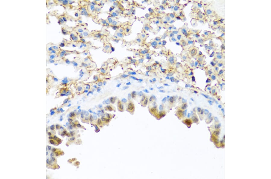 Immunohistochemistry - Anti-Elafin/ESI Antibody (A11834) - Antibodies.com
