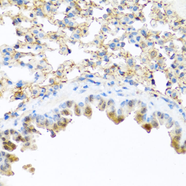 Immunohistochemistry - Anti-Elafin/ESI Antibody (A11834) - Antibodies.com