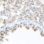 Immunohistochemistry - Anti-Elafin/ESI Antibody (A11834) - Antibodies.com