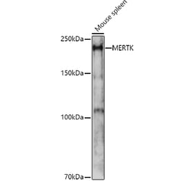 Western Blot - Anti-MERTK Antibody (A11835) - Antibodies.com