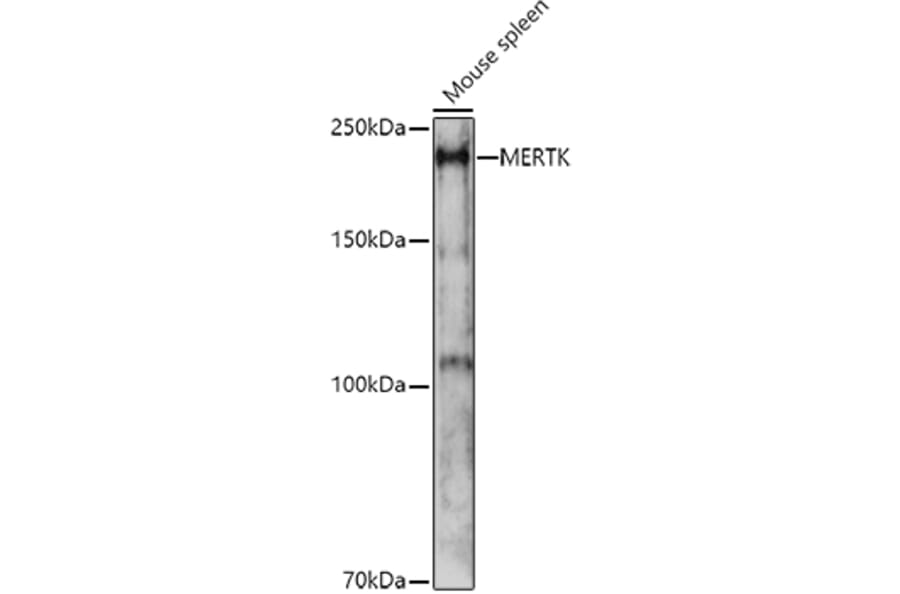 Western Blot - Anti-MERTK Antibody (A11835) - Antibodies.com