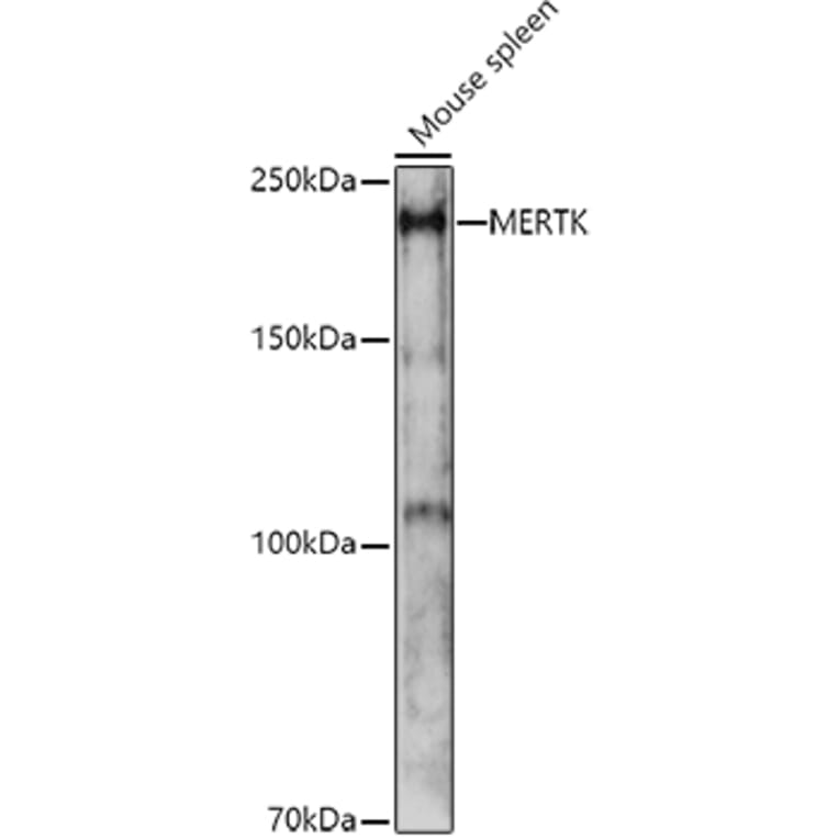 Western Blot - Anti-MERTK Antibody (A11835) - Antibodies.com