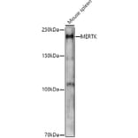 Western Blot - Anti-MERTK Antibody (A11835) - Antibodies.com